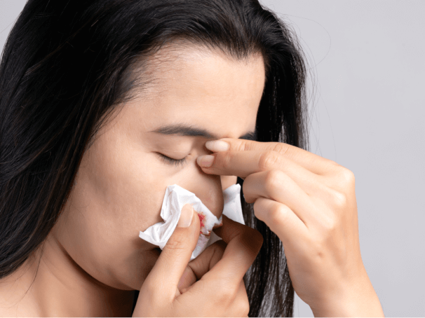 Bleeding Nose: An Unusual Anxiety Symptom