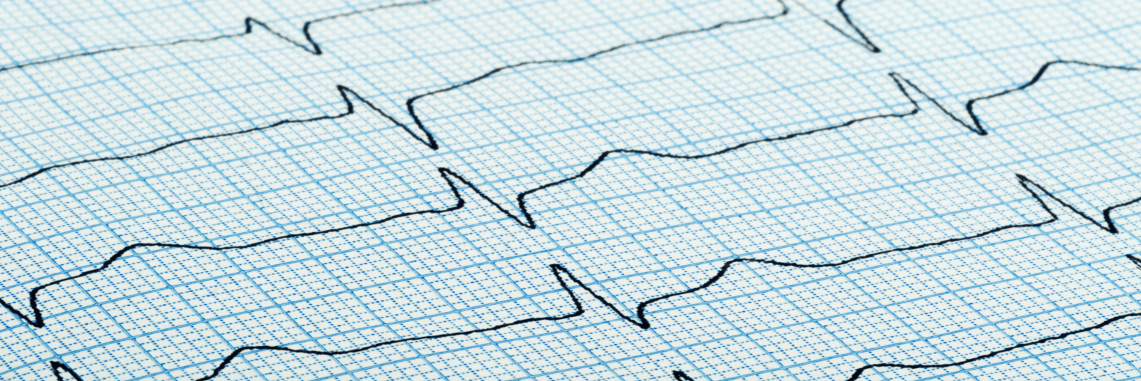 How Tachycardia Affects Healthy People with Anxiety