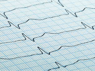 How Tachycardia Affects Healthy People with Anxiety