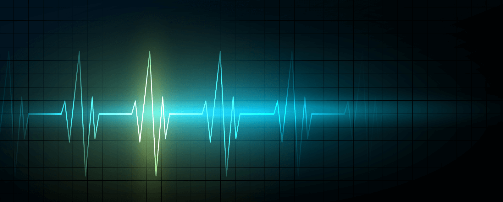 Regular Anxiety and Irregular Heartbeat