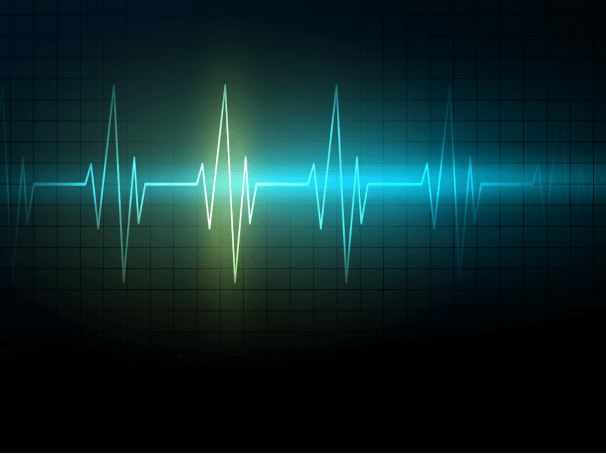 Regular Anxiety and Irregular Heartbeat