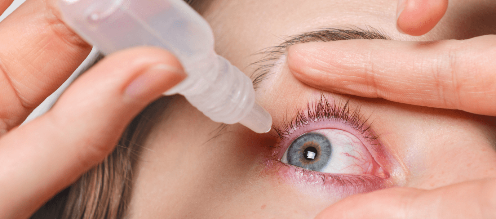 Anxiety May Cause Eye Pain