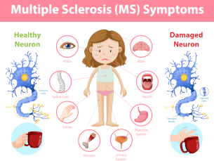 The Relationship Between Multiple Sclerosis and Anxiety