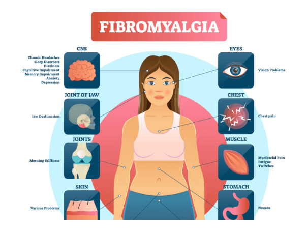 How Are Anxiety and Fibromyalgia Connected?